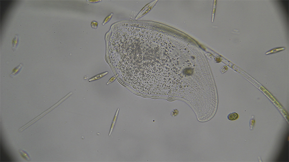 Microscopy: Loxophyllum Ciliado Ciliate 03