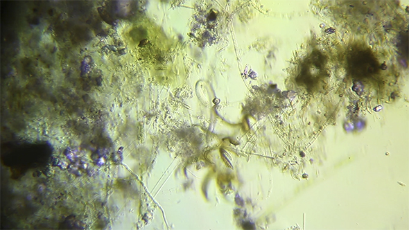 Microscopy: Cultivation. Different Bacterial Colonies 4