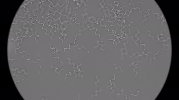 Colony of Bacteria Spirochetes alt