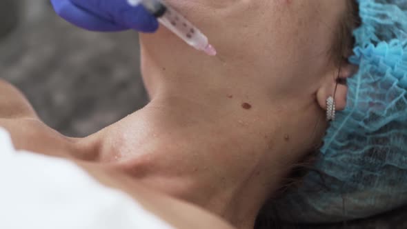 Woman on the Procedure of Mesotherapy Injection with a Syringe alt