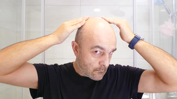 Bald Man Scared Of Losing Hair
