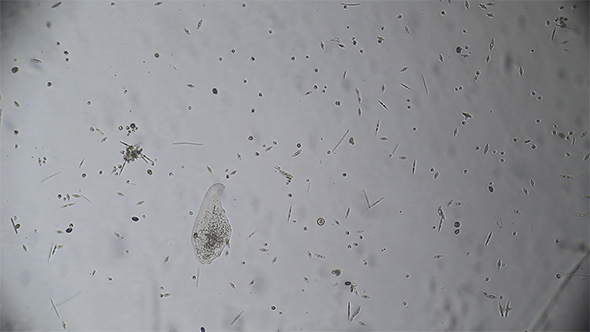 Microscopy: Loxophyllum Ciliado Ciliate 05