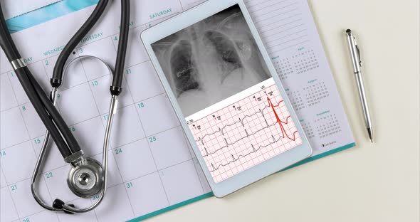 After Installed Pacemakers Xray Chest and Electrocadiogram of Wave Report in Digital the Tablet View alt