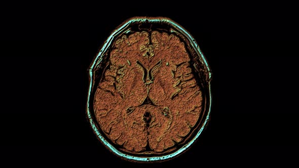 Bulk Multicolored MRI Scans of the Brain and Head To Detect Tumors. Diagnostic Medical Tool alt