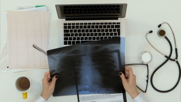 Female Doctor Hands Holding Xray Image alt