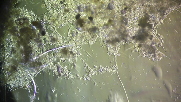 Microscopy: Cultivation. Different Bacterial Colonies 7