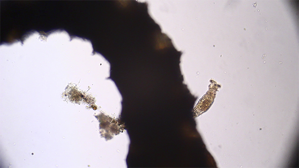 Microscopy: Rotifer Mniobia Magna on a Microscopic Larva 02