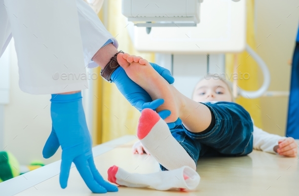 Broken Leg X Ray Scanning Stock Photo by duallogic | PhotoDune