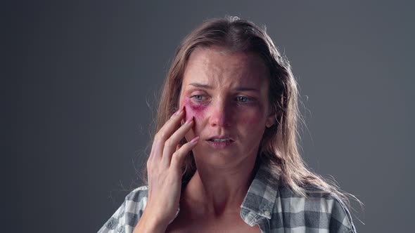 Woman Victim of Domestic Violence Touches His Face with Bruises and Abrasions