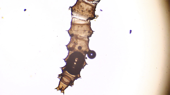 Microscopy: Rotifer Mniobia Magna on a microscopic larva 01