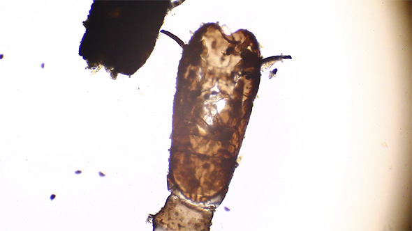Microscopy: Rotifer Mniobia Magna on a Microscopic Larva 07