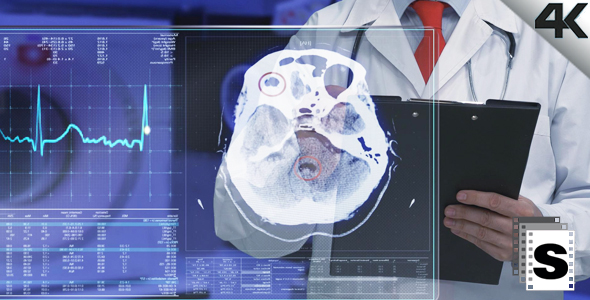 Doctor Examines MRI alt