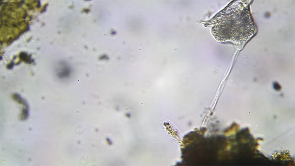 Microscopy: Vorticella SP 13