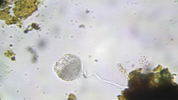 Microscopy: Vorticella SP 14