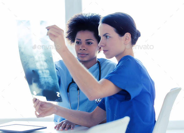 doctors with x-ray image of spine at hospital - Stock Photo - Images