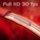 Angioplasty and stenting - VideoHive Item for Sale
