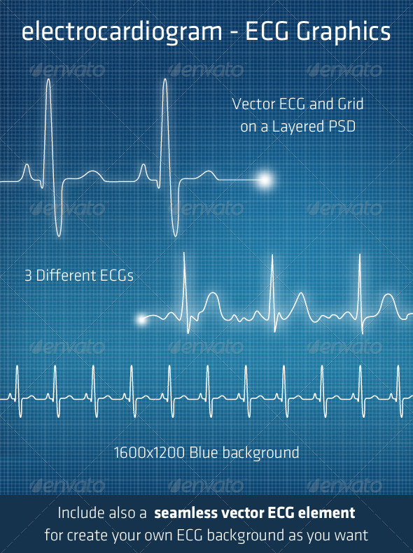 ECG - Electrocardiogram Background Elements - Technology Conceptual