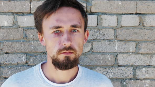 Portrait of European Man with Bruises Cuts on Face alt