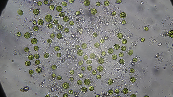 Microscopy: Pteromonas Angulosa alga-Algae 03