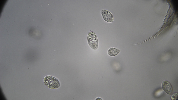 Microscopy: Scuticociliate Ciliado Ciliate 01