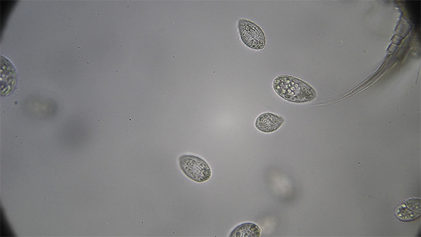 Microscopy: Scuticociliate Ciliado Ciliate 02