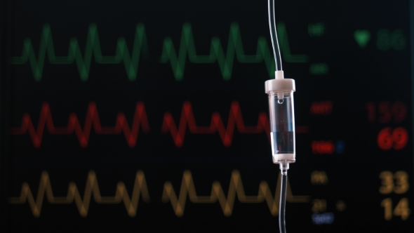 VideoHive Monitor Control of Cardio Surgery 20425184 VideoHive Monitor Control of Cardio Surgery 20425184