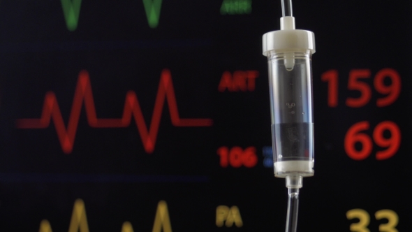 VideoHive Cardio Surgery Is Being Reflected On Monitor 20425196 VideoHive Cardio Surgery Is Being Reflected On Monitor 20425196
