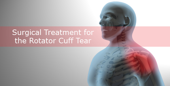 Surgical Treatment For The Rotator Cuff Tear, Motion Graphics | VideoHive