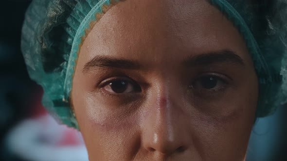 Woman Doctor on Her Face Marks Are Visible From Protective Mask, Red Spots alt