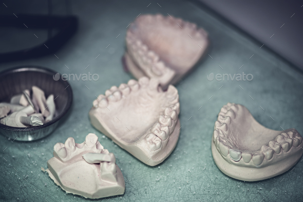 Dental Prosthesis Prosthetic Laboratory