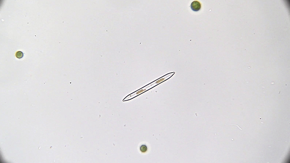 Microscopy: Diatoms SP 01