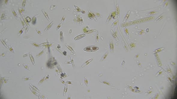 Microscopy: Diatoms SP 02