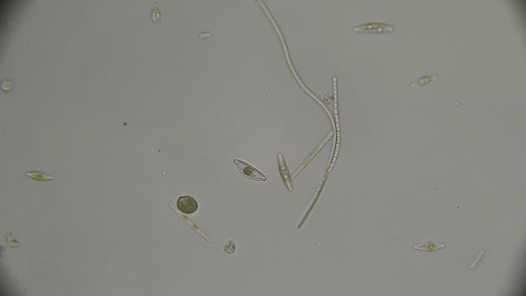 Microscopy: Diatoms SP 03
