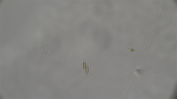 Microscopy: Diatoms SP 04