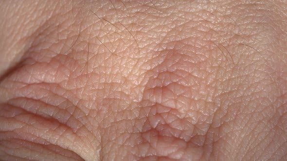 Human Skin Macro Background alt