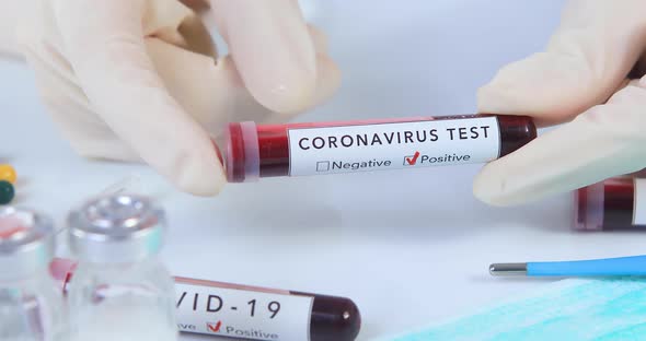 Doctor Analyzing Coronavirus COVID 19 Test Blood