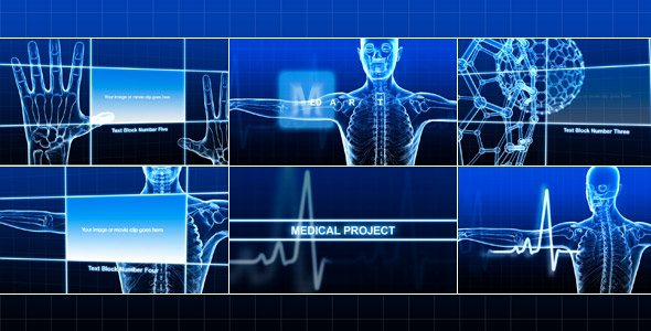 Medical Project - VideoHive 236064