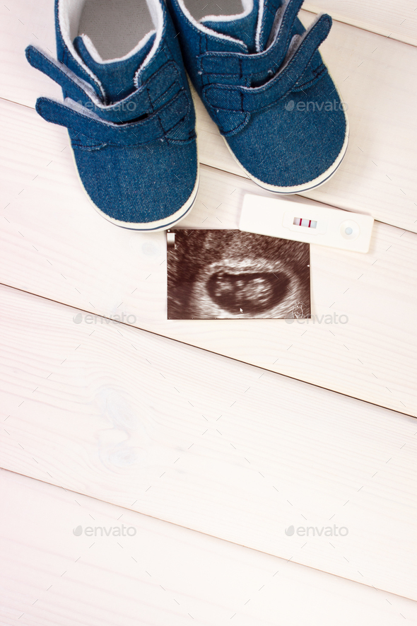 Pregnancy test, ultrasound scan of baby and baby shoes lying on boards, expecting for baby - Stock Photo - Images