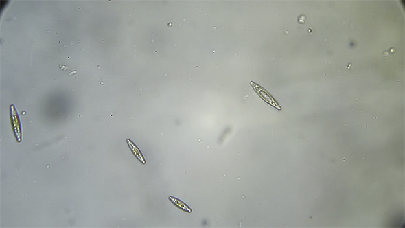 Microscopy: Diatoms SP 09