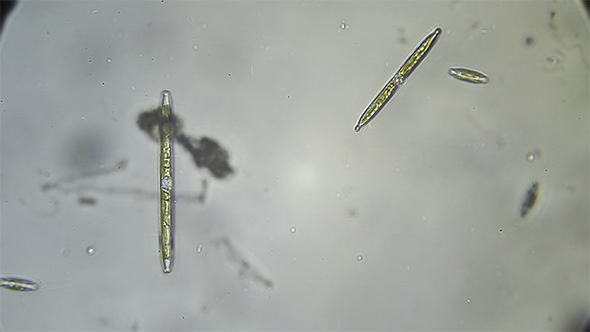 Microscopy of Diatoms SP 05