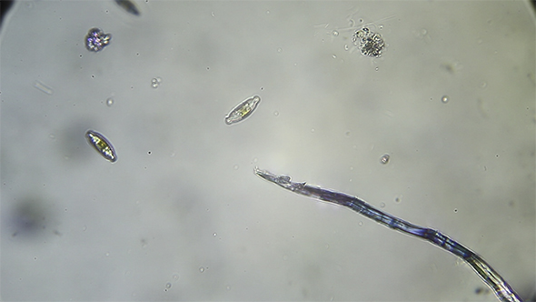 Microscopy: Diatoms SP 06