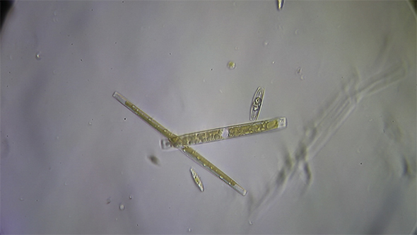 Microscopy: Diatoms SP 08