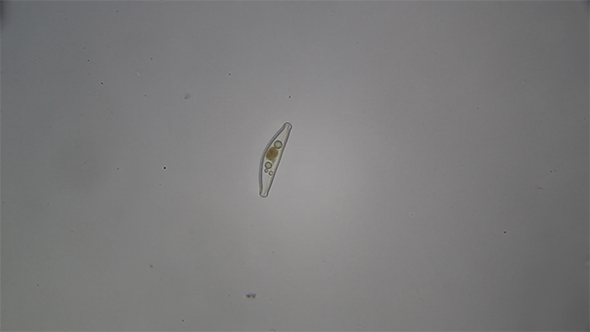Microscopy: Diatoms SP 07