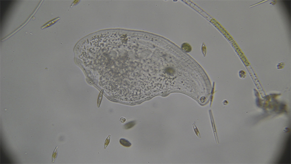 Microscopy: Loxophyllum Ciliado Ciliate 06