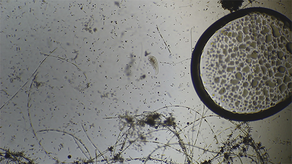 Microscopy: Loxophyllum Ciliado Ciliate 04