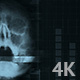 Interface Scan of a Human Skull, 5 in 1 - VideoHive Item for Sale