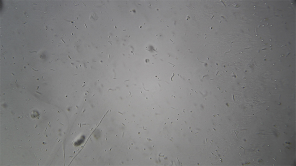 Microscopy: Cultivation Different bacterial colonies 8