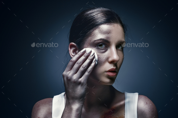 Close up portrait of a crying woman with bruised skin and black eyes - Stock Photo - Images
