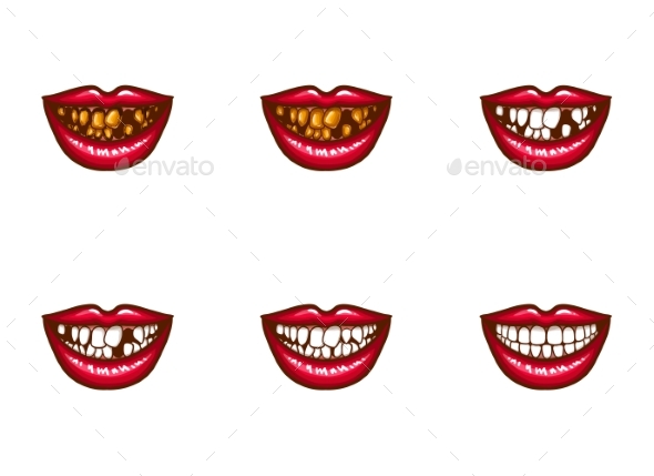 Clipart of Female Mouths with Dental Problems - Miscellaneous Vectors