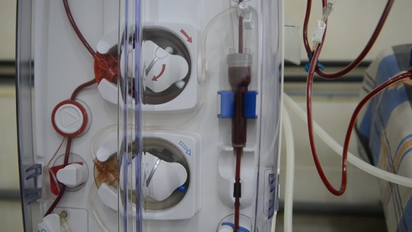 Hemodialysis Machines with Tubing.
